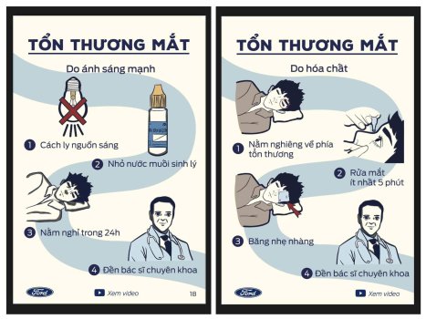 Cách sơ cứu khi đột quỵ, đuối nước, điện giật, rắn cắn,...  XEtv (18).jpg